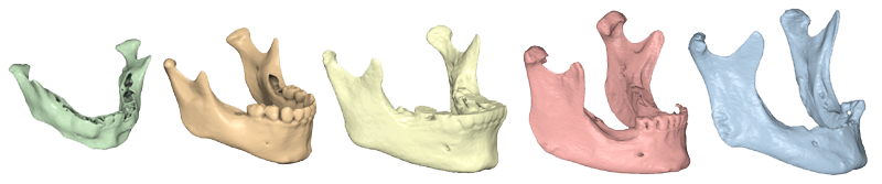 [mandible models]