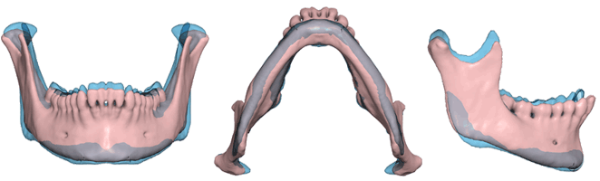 [male-female mandibles]