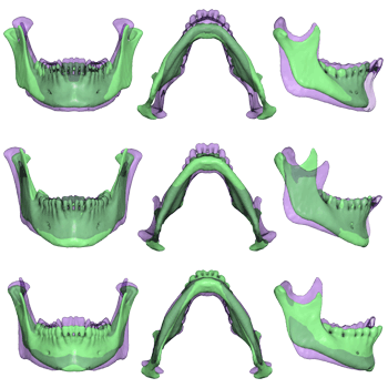 [mandible template]